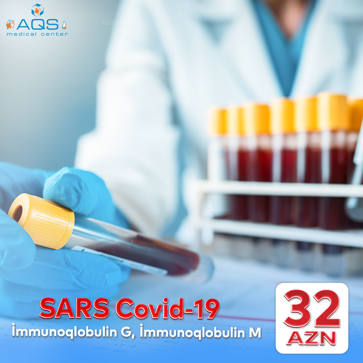 SARS Covid-19 - İmmunoqlobulin G və İmmunoqlobulin M analizləri CƏMİ 32 AZN 